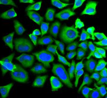 BAD Rabbit Polyclonal Antibody