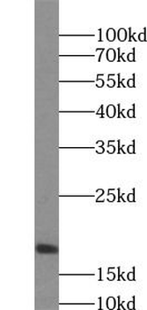 BAD Rabbit Polyclonal Antibody