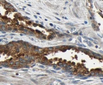 BAD Rabbit Polyclonal Antibody