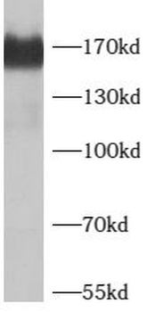 SMARCC2 Rabbit Polyclonal Antibody