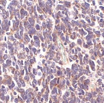 SMARCC2 Antibody