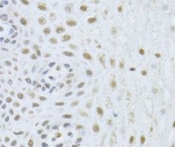 BAG1 Antibody