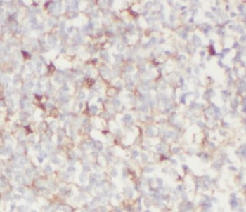 BAK1 Antibody