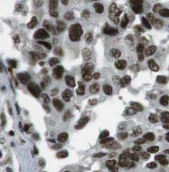 BANP Rabbit Polyclonal Antibody