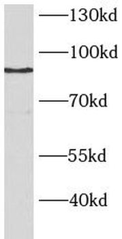 BAP1 Rabbit Polyclonal Antibody