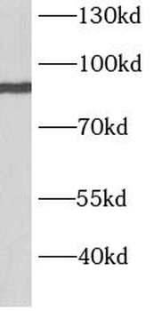 BARD1 Antibody