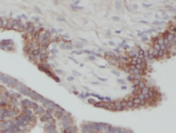 BAX Antibody