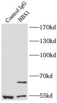 BBS1 Antibody