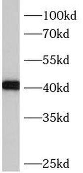 BBS5 Antibody