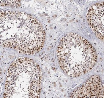 BBS5 Antibody