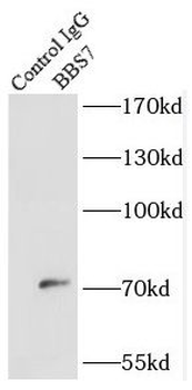 BBS7 Antibody