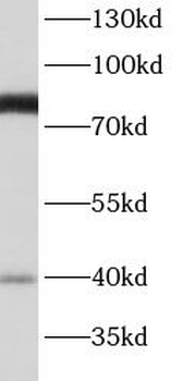 BBS7 Antibody