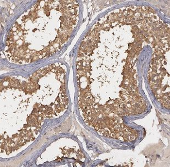 BBS7 Antibody