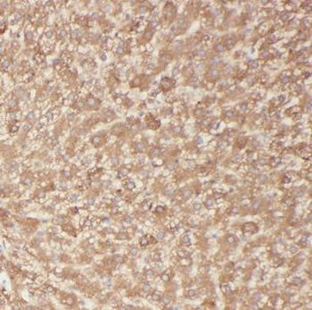 BBS9 Antibody