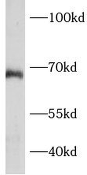 BCAS1 Rabbit Polyclonal Antibody