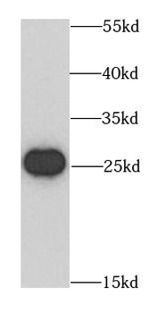 BCAS2 Antibody