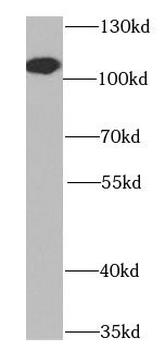 BCAS3 Antibody