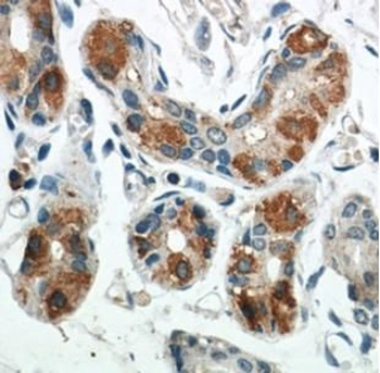 BCAT2 Antibody