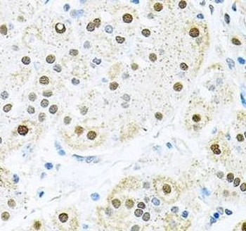 BCCIP Antibody