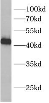 BCKDHB Rabbit Polyclonal Antibody
