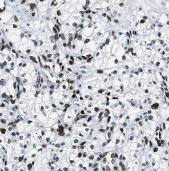 BCKDHB Antibody