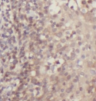BCL2 Antibody