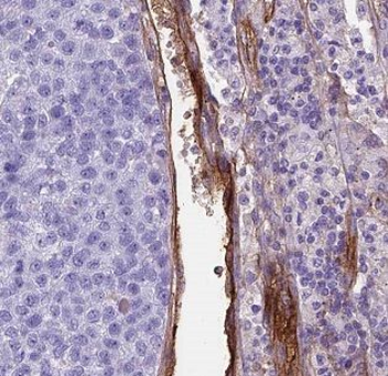 BCL2L13 Antibody