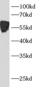 BCL3 Rabbit Polyclonal Antibody