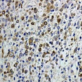 BCL3 Rabbit Polyclonal Antibody