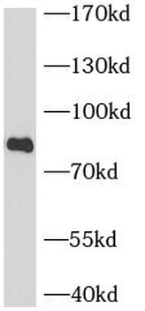 BCL6 Rabbit Polyclonal Antibody