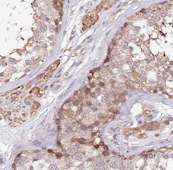 BCO1 Antibody