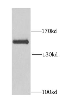 BCR Rabbit Polyclonal Antibody