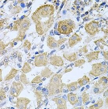 BCR Rabbit Polyclonal Antibody