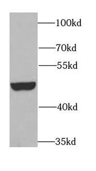BCS1L Antibody