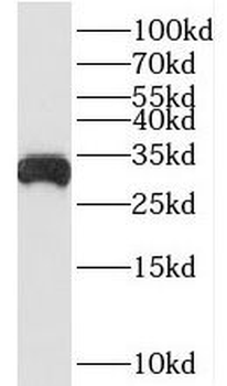 BDH1 Antibody