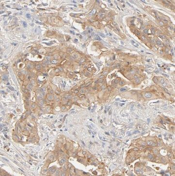 BEGAIN Antibody