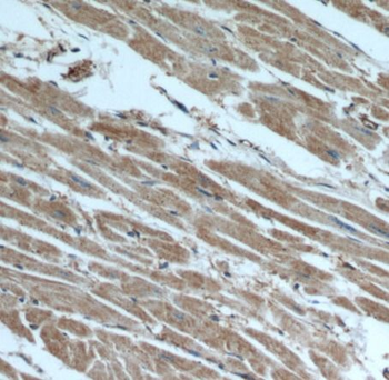 beta actin Antibody