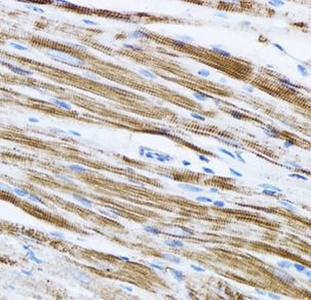 beta actin Antibody