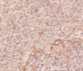 ARRB1 Antibody