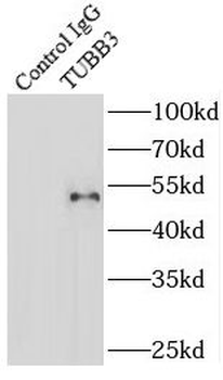 Beta Tubulin Antibody