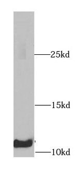 B2M Antibody