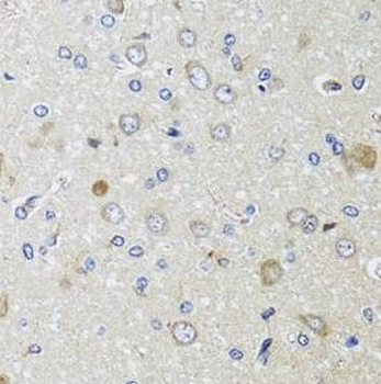 B2M Antibody
