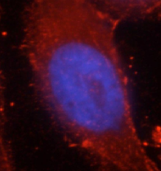 CTNNB1 Rabbit Polyclonal Antibody
