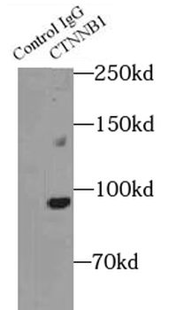 CTNNB1 Rabbit Polyclonal Antibody
