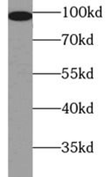 CTNNB1 Rabbit Polyclonal Antibody