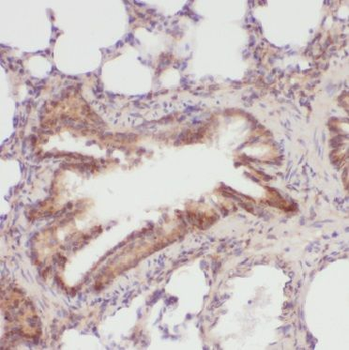 BGN Antibody