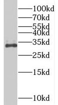 BIVM Rabbit Polyclonal Antibody