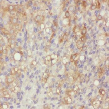 BIVM Rabbit Polyclonal Antibody