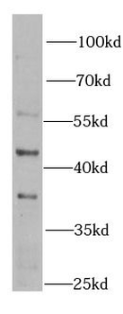 BLMH Antibody