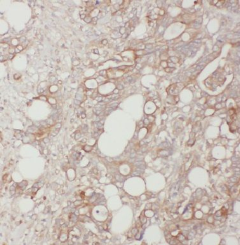 BLMH Antibody